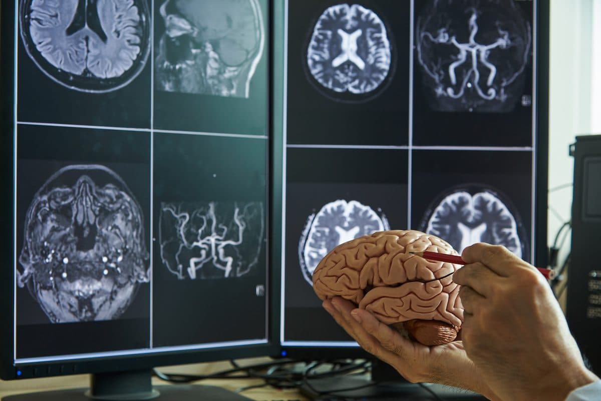 Valoración neurológica con estudios de imagen cerebral